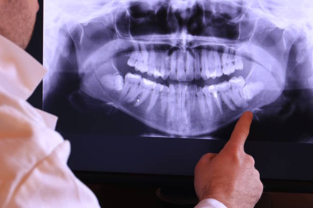 Best After-Hours Emergency Dentist in Olympia Heights, FL