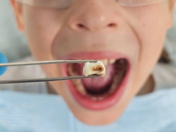 Best Emergency Broken Tooth Repair in Olympia Heights, FL